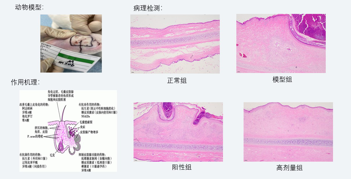 案例3:新西兰兔痤疮药效研究.jpg 案例3:新西兰兔痤疮药效研究.jpg